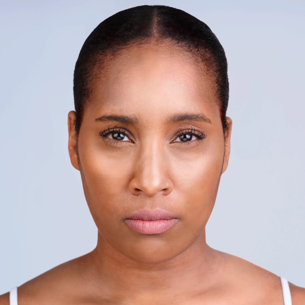 dermal-fillers-11-Broklyn-NY-Park-Slope-Laser