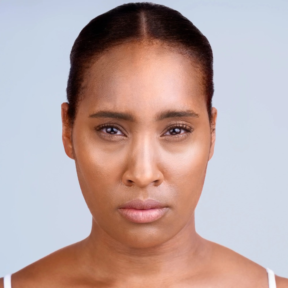 dermal-fillers-10-Broklyn-NY-Park-Slope-Laser
