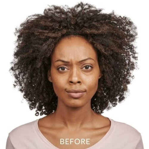 JEAVEAU-before-and-after-1a-park-slope-laser-brookly-NY